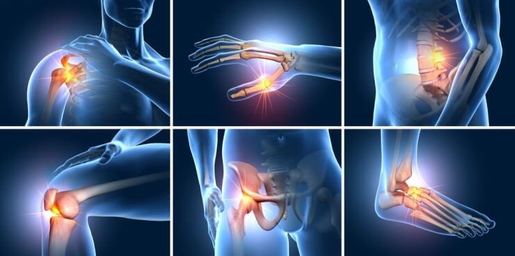 Hình ảnh đau khớp xương: tay, vai, đầu gối, lưng, hông và bàn chân với ánh sáng đỏ biểu thị chỗ đau.
