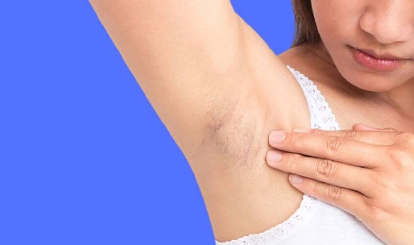 Người mặc áo trắng giơ tay lên, tay kia chạm vào vùng dưới cánh tay, nền xanh dương.