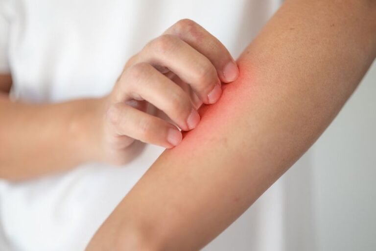 Bị Ngứa Sau Khi Triệt Lông Vĩnh Viễn: Nguyên Nhân Và Cách Khắc Phục Hiệu Quả