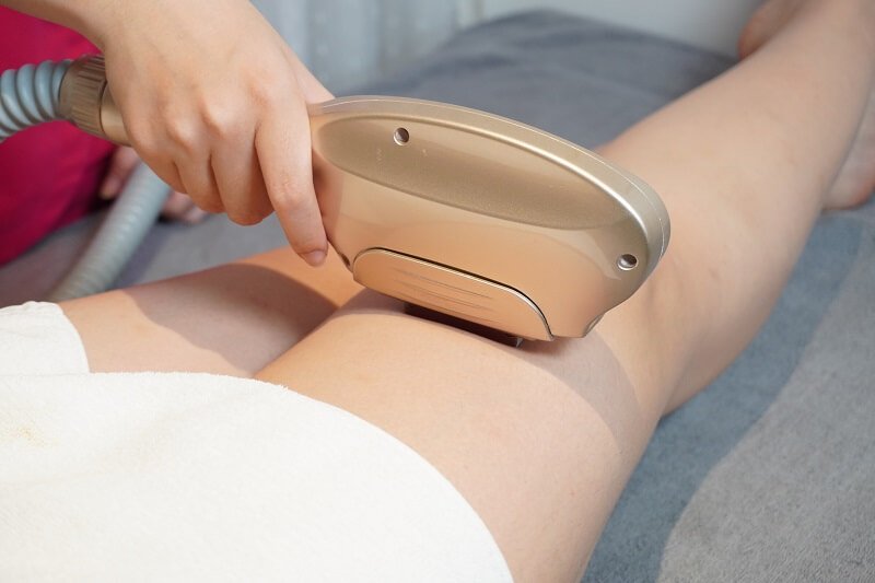 Tay cầm máy triệt lông đang hoạt động trên chân của một người nằm trên giường với khăn trắng phủ.