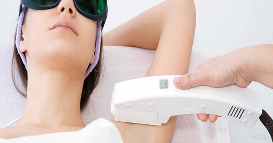Người đang thực hiện liệu pháp triệt lông bằng laser ở vùng nách, đeo kính bảo vệ mắt.