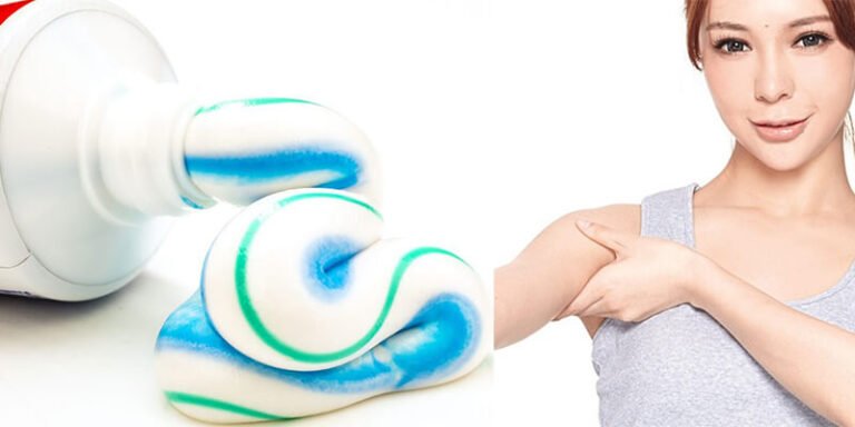 Top 6 Mẹo Trị Hôi Nách Bằng Kem Đánh Răng Đơn Giản, Hiệu Quả Nhanh Chóng
