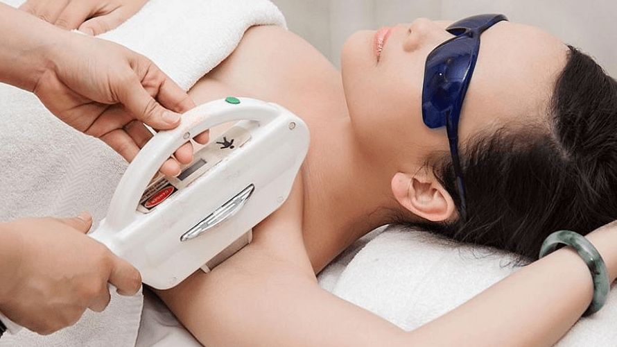 Người phụ nữ đeo kính bảo hộ đang được điều trị laser vùng nách trong một cơ sở thẩm mỹ.
