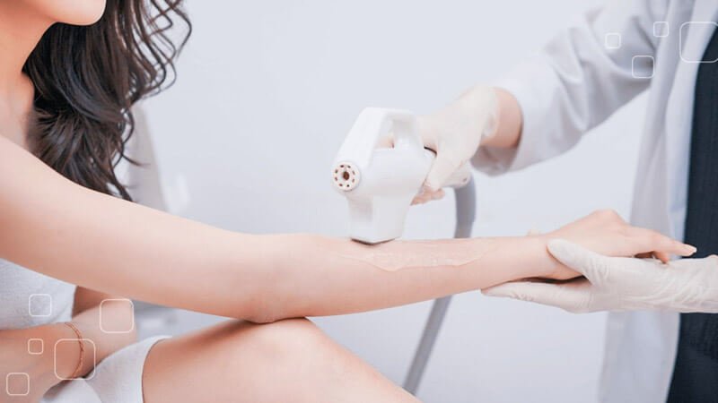 Người đang thực hiện liệu trình chăm sóc da bằng thiết bị chuyên dụng trên cánh tay trong môi trường y tế.