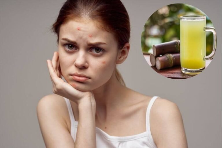 Uống Nước Mía Có Nổi Mụn Không? Lợi Ích Và Lưu Ý Khi Thưởng Thức