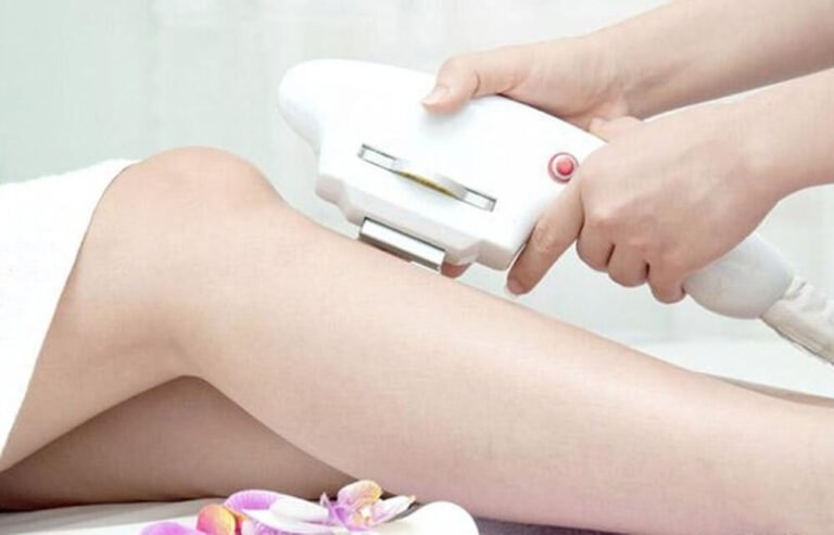 Tư Vấn Triệt Lông: Tổng Hợp Kinh Nghiệm Triệt Lông Hữu Ích Cho Người Mới