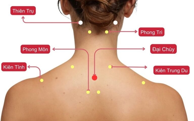 Vị trí các huyệt vùng vai gáy: Cách giảm đau HIỆU QUẢ