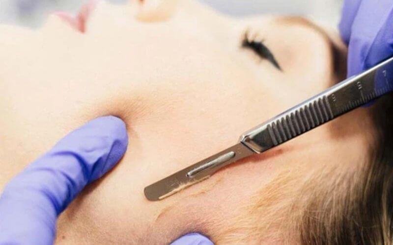Người đeo găng tay xanh sử dụng dao cạo để chăm sóc da mặt cho khách hàng.