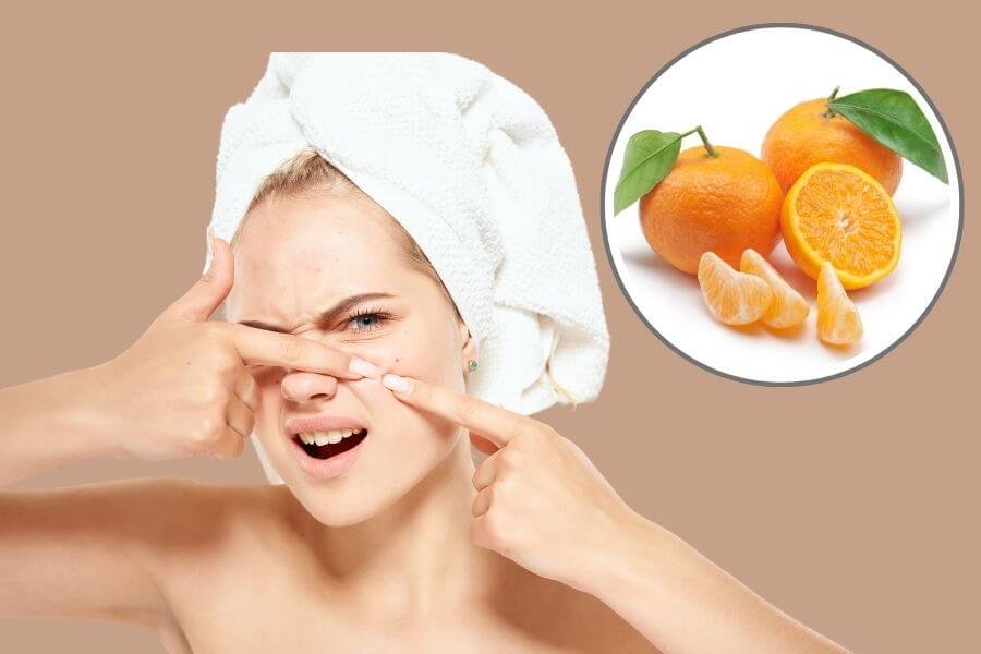 Người đội khăn tắm, chạm vào mũi; bên cạnh là hình ảnh quả cam và lát cam.