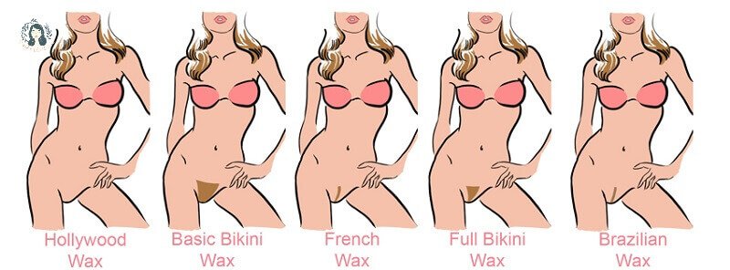 Hình minh họa các kiểu tẩy lông bikini khác nhau với năm phong cách khác nhau được mô tả.