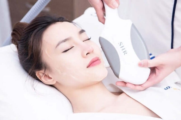 Triệt Lông Mặt Giá Bao Nhiêu? Tìm Hiểu Chi Phí Và Lưu Ý Quan Trọng