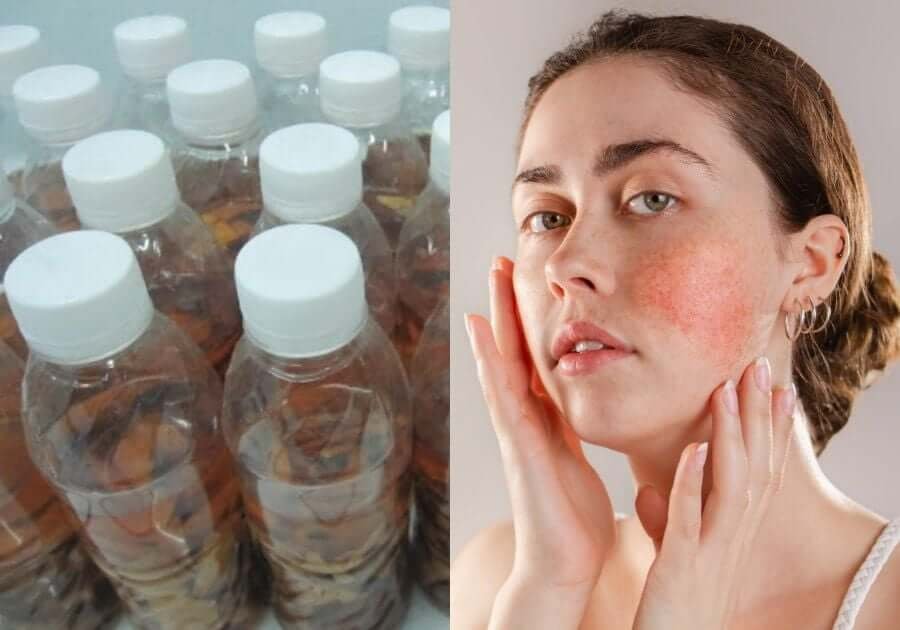 Hình ảnh gồm nhiều chai nhựa và một người đang chạm vào vùng da đỏ trên má.