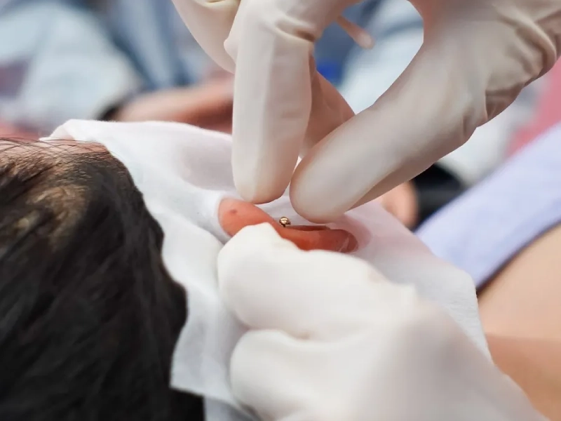 dia-chi-xo-khuyen-tai-ha-noi-5-1 Trải nghiệm dịch vụ xỏ khuyên chất lượng tại Vịt Xỏ Khuyên